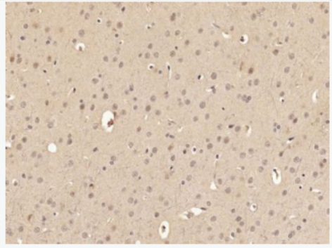Anti-Phospho-FoxO3a (Ser318 + Ser321) antibody-磷酸化叉头蛋白3A抗体