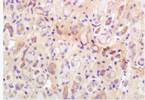 Anti-phospho-IRS1 (Ser307) antibody-磷酸化胰岛素受体底物1 p-IRS-1/2抗体