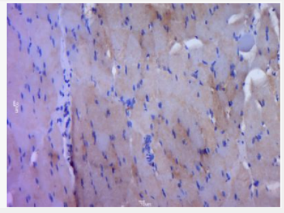 Anti-phospho-EGFR (Tyr1068) antibody-磷酸化表皮生长因子受体抗体