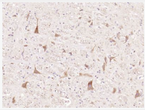 Anti-phospho-Tau (Ser235) antibody-磷酸化微管相关蛋白抗体