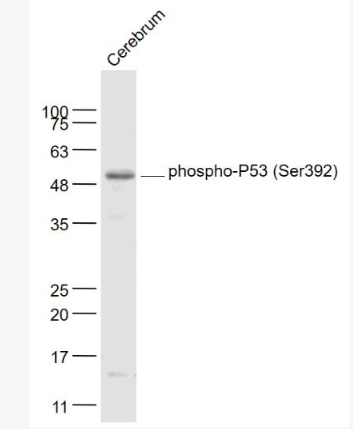 Anti-phospho-P53 (Ser392) antibody-磷酸化肿瘤抑制基因P53抗体
