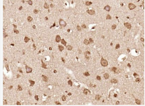 Anti-Phospho-IKK alpha (Thr23) antibody-磷酸化KB抑制蛋白激酶α/IKK α 抗体