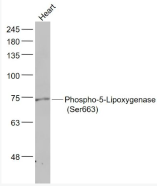 Anti-Phospho-ALOX5 (Ser663) antibody-磷酸化5-脂氧合酶抗体