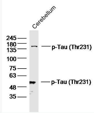 Anti-phospho-Tau (Thr231) antibody-磷酸化微管相关蛋白抗体