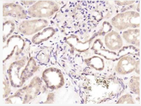 Anti-phospho-Dnmt1 (Ser154) antibody-磷酸化DNA甲基转移酶1抗体