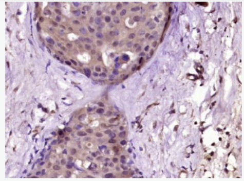 Anti-phospho-ERK5 ( Ser731+Thr733) antibody-磷酸化细胞外信号调节激酶5抗体