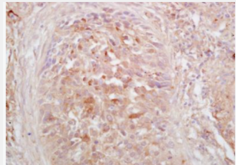 Anti-phospho-HSF1 (Ser326) antibody-磷酸化热休克因子1抗体