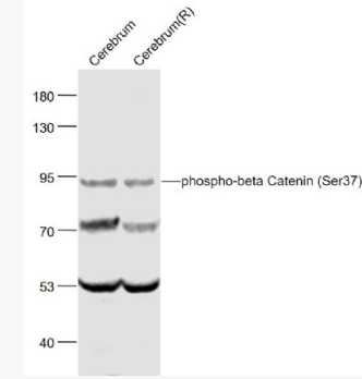 Anti-phospho-beta Catenin (Ser37) antibody-磷酸化β-连环蛋白/β-连环素/β链接素抗体
