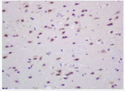 Anti-Transglutaminase-1 antibody-谷氨酰胺转胺酶1抗体