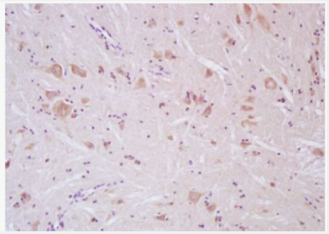 Anti-SCN10A/Nav1.8 antibody-钠通道蛋白10α抗体