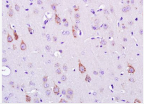 Anti-SEMA6D antibody-轴突导向因子SEMA6D抗体