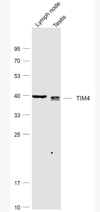 Anti-TIM4 antibody-T淋巴细胞膜蛋白4抗体