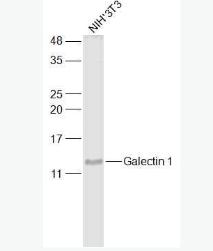 Anti-Galectin 1 antibody-半乳糖凝集素1抗体