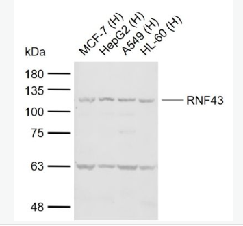 Anti-RNF43  antibody-环指蛋白43抗体
