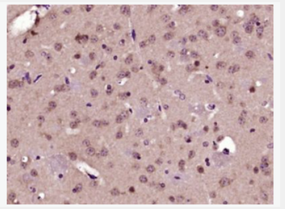 Anti-Bcl2L2 antibody-Bcl-2样蛋白2抗体