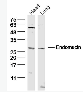 Anti-Endomucin  antibody-内皮粘蛋白EMCN抗体