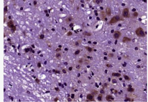 Anti-DNase II antibody-脱氧核糖核酸酶2抗体