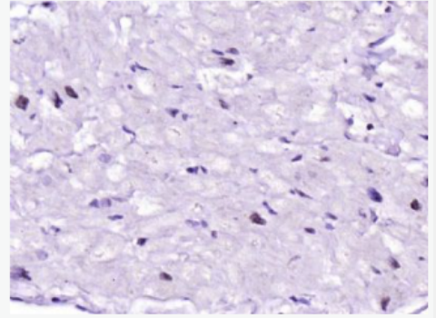 Anti-Nkx2.5  antibody-心脏特异性同源盒转录因子NKX2.5抗体