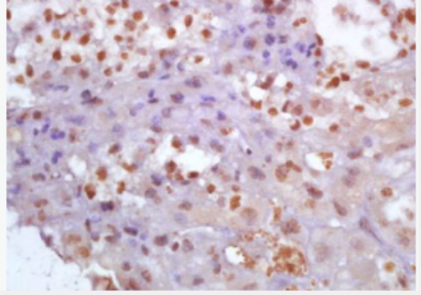 Anti-Glutamine PRPP amidotransferase antibody-谷氨酰胺磷酸核糖基焦磷酸酰胺基转移酶