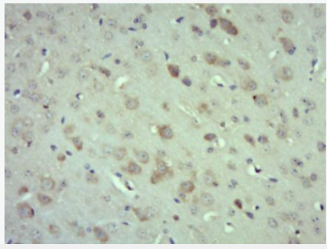 Anti-GADD45G antibody-GADD45G抗体