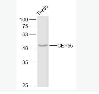 Anti-CEP55 antibody-中心体蛋白55kDa抗体
