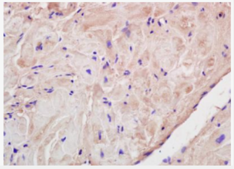 Anti-Corin antibody-心脏特异性丝氨酸蛋白酶抗体