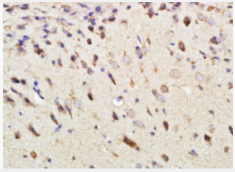 Anti-DEPTOR antibody-DEPTOR蛋白抗体