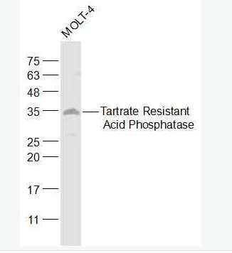 Anti-ACP5 antibody-抗酒石酸酸性磷酸酶5型/5型酸性磷酸酶抗体