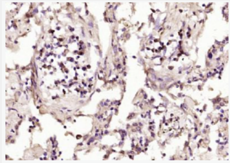 Anti-NCF1 antibody-NADPH氧化酶活化蛋白p47抗体