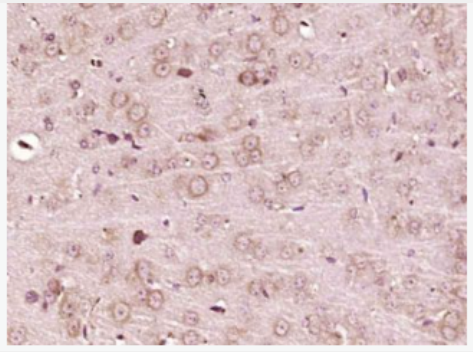Anti-POMC  antibody-阿黑皮素原抗体