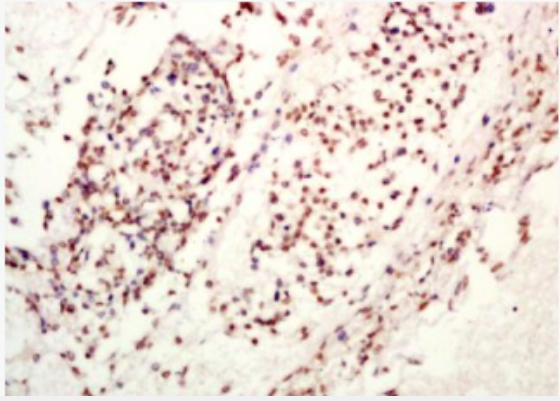 Anti-TET1 antibody-Ten-eleven转运基因1蛋白抗体