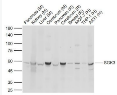 Anti-SGK3 antibody-丝氨酸/苏氨酸蛋白激酶Sgk3抗体