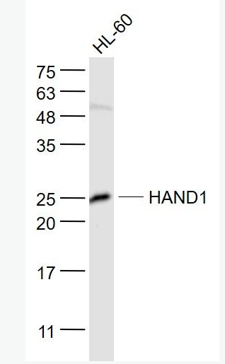 Anti-HAND1  antibody-心脏和神经嵴衍生蛋白1抗体