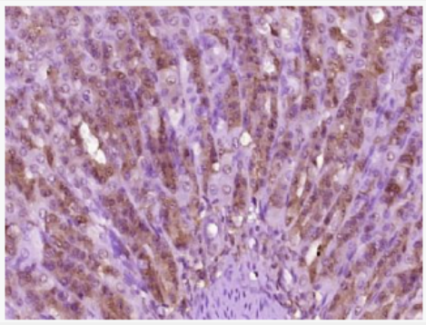 Anti-Lubricin antibody-巨核细胞刺激因子/蛋白多糖4/浅表层粘膜蛋白多糖抗体