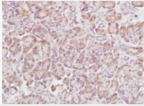 Anti-Rho B antibody-RhoB蛋白抗体
