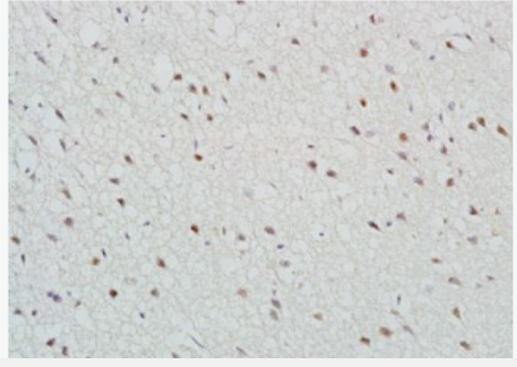 Anti-TBR2  antibody-脱中胚蛋白抗体