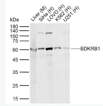 Anti-BDKRB1 antibody-缓激肽B1受体抗体