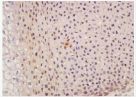 Anti-SUFU antibody-SUFU抗体