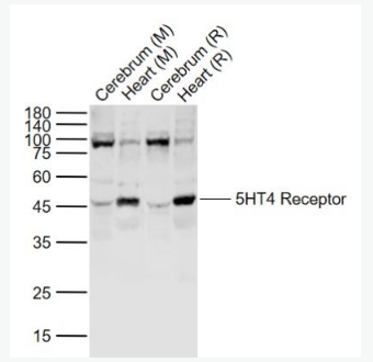 Anti-5HT4 Receptor antibody-5-羟色胺受体4抗体
