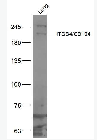 Anti-ITGB4/CD104 antibody-整合素β4抗体