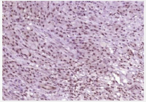 Anti-phospho-ATM (Ser794) antibody-磷酸化毛细血管扩张性共济失调症突变蛋白抗体