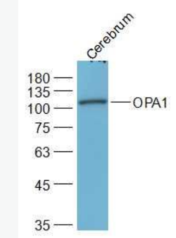Anti-OPA1 antibody-视神经萎缩相关蛋白1抗体