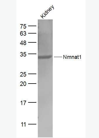 Anti-Nmnat1 antibody-烟酰胺核苷酸腺苷转移酶1抗体