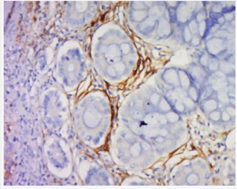 Anti-IL18 antibody-白介素18抗体