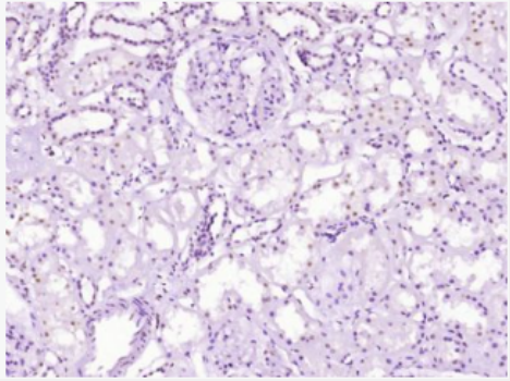 Anti-phospho-DDX5 (Tyr593) antibody-磷酸化三磷酸腺苷依赖解旋酶ddx5抗体