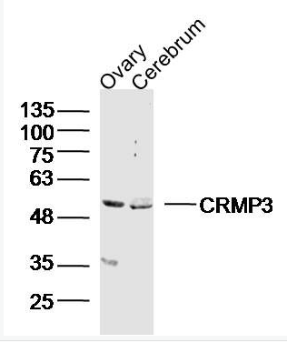 Anti-CRMP3 antibody-二氢嘧啶酶相关蛋白3抗体