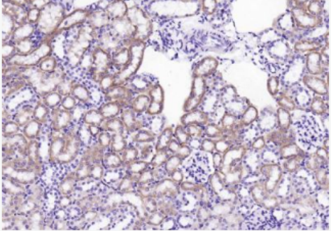 Anti-GBA3 antibody-β葡萄糖苷酶3抗体
