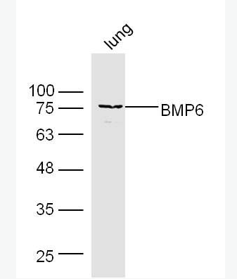 Anti-BMP6 antibody-骨形态发生蛋白6抗体