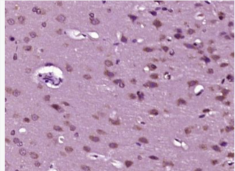Anti-phospho-PKC Epsilon (Ser729) antibody-蛋白激酶Cε型抗体
