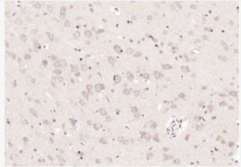 Anti-METTL3 antibody-甲基转移酶样蛋白3抗体
